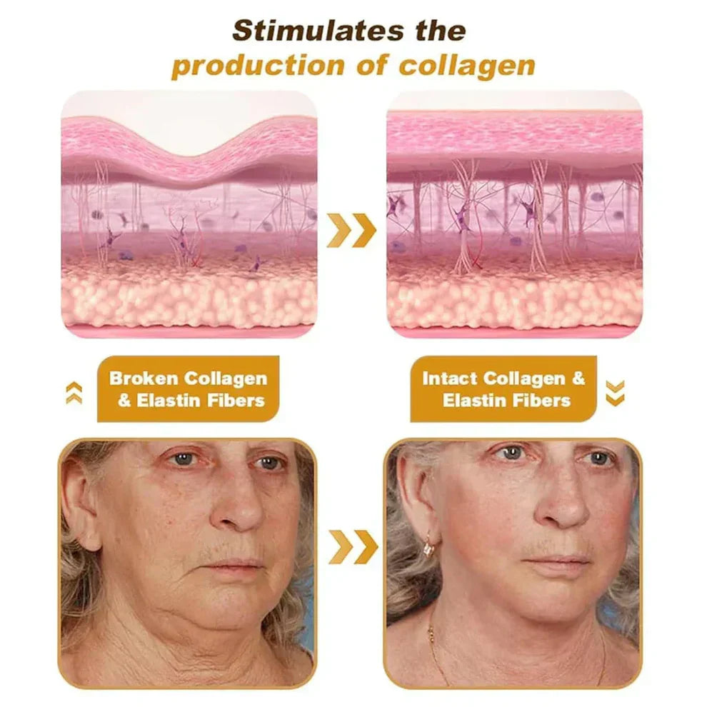Bee Venom Botox Wrinkle Repair Cream